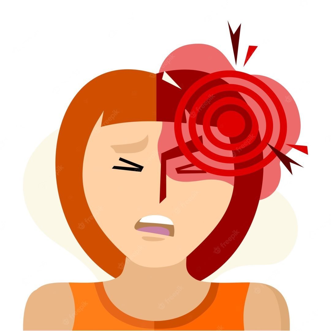 Chronic Migraine Relief